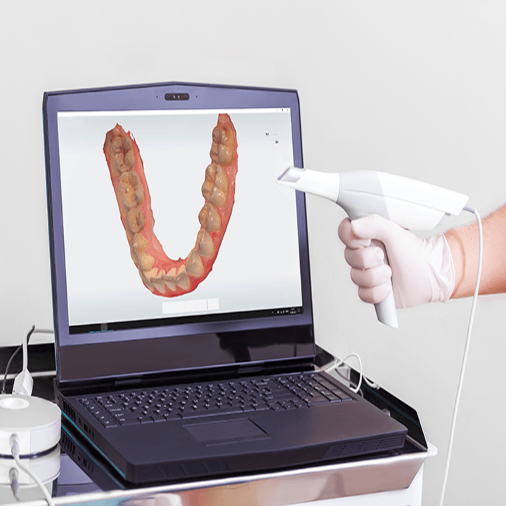 Dental Impression or Digital Scan (1) (1)